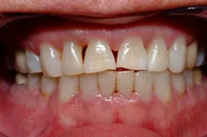 Online Smile Gallery Case 2 Before Photo