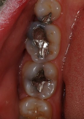 Hayden Family Dental Center, PLLC Smile Gallery Case 11 Before Photo