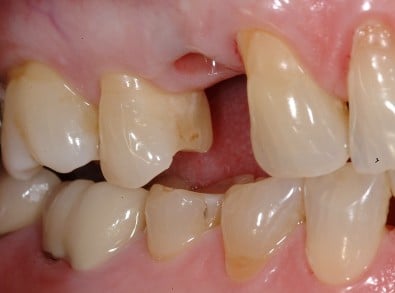 Hayden Family Dental Center, PLLC Smile Gallery Case 12 Before Photo