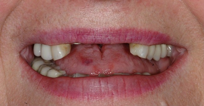 Hayden Family Dental Center, PLLC Smile Gallery Case 13 Before Photo